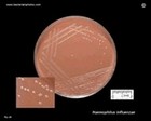 Haemophilus influenzae on agar